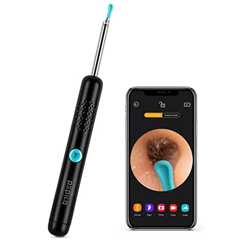 Black Wireless Otoscope with 1080P HD Camera F4614