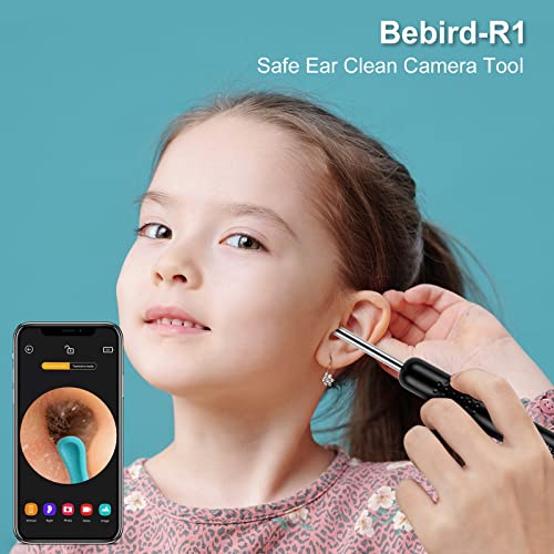 Black Wireless Otoscope with 1080P HD Camera F4614