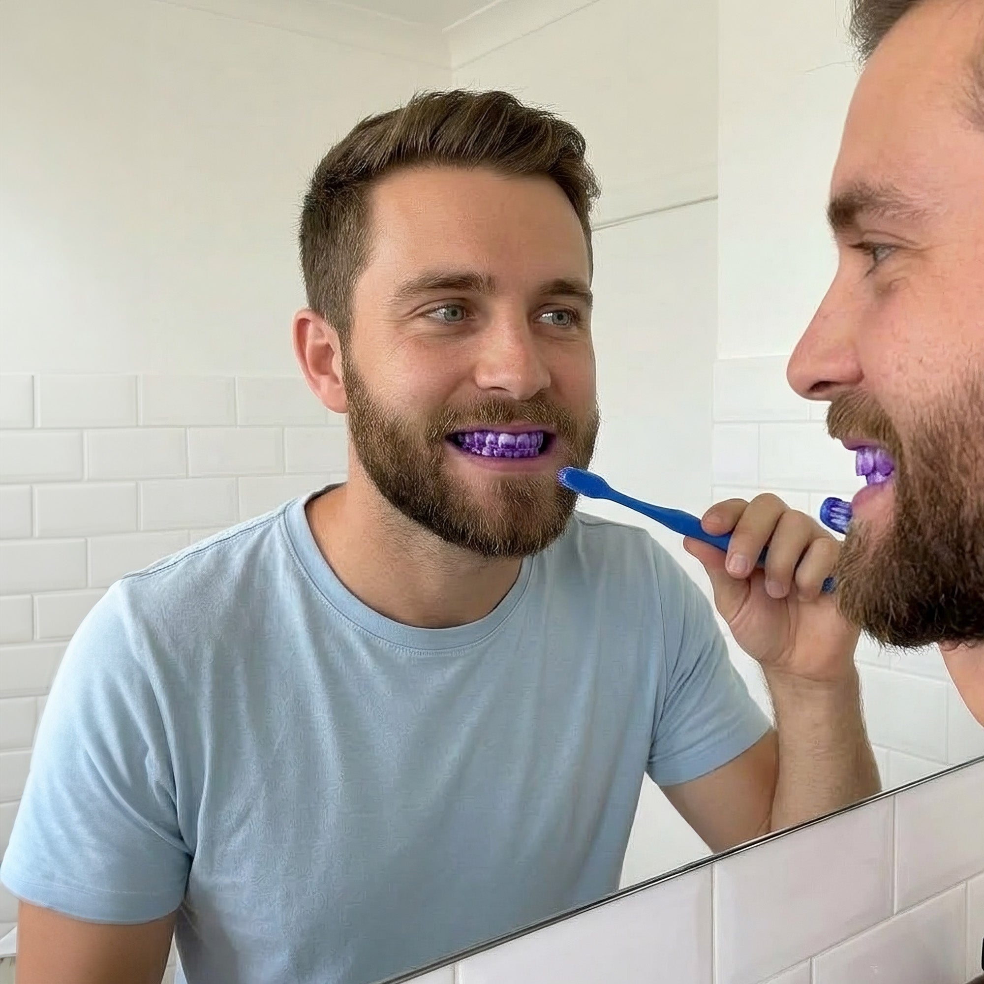 Total Smile Confidence System: Professional Teeth Whitening Strips, Teeth Whitening Serum & Teeth Whitening Pen